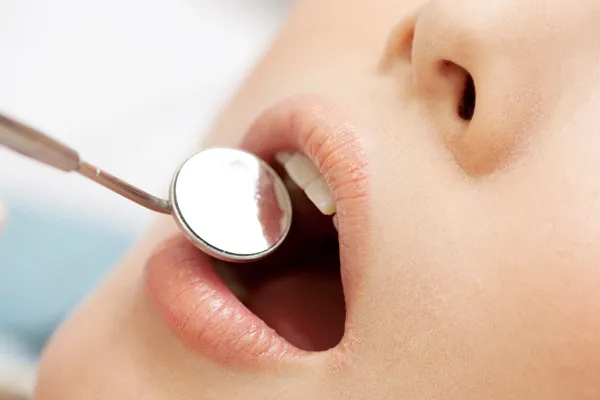 定期検診のすすめ