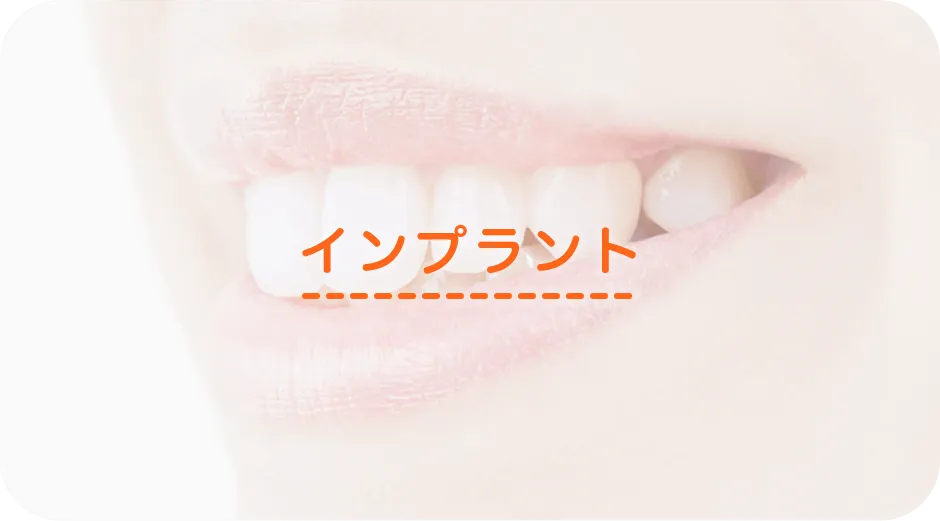インプラント