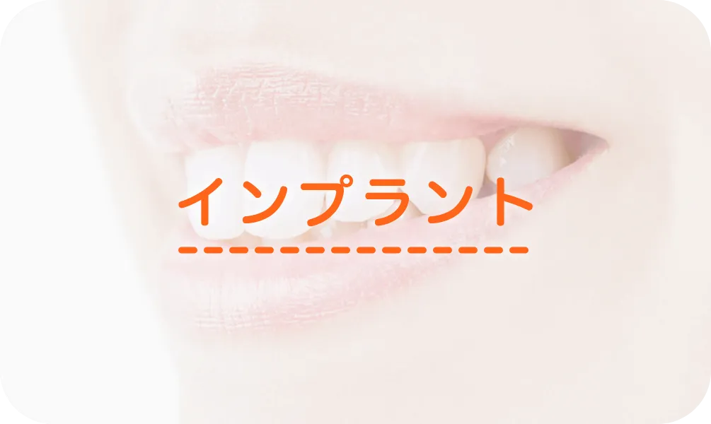 インプラント